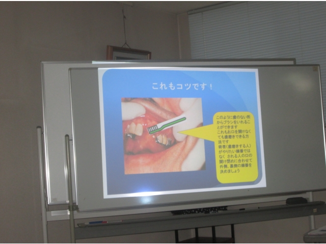 利用者さんの口腔状態を確認